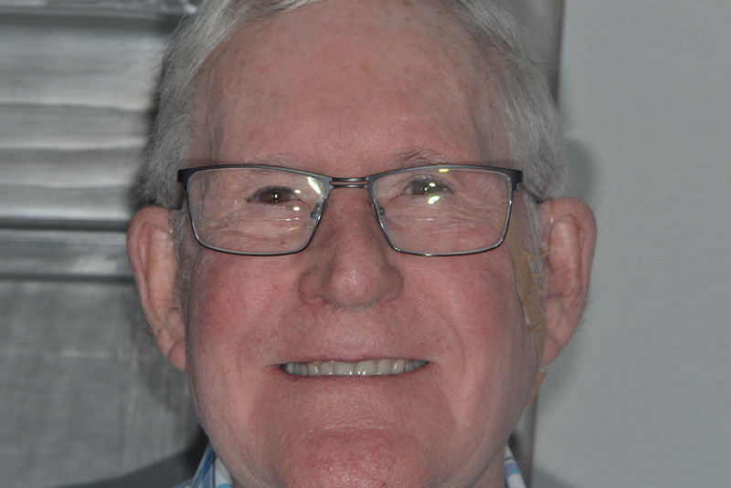 after dental treatment