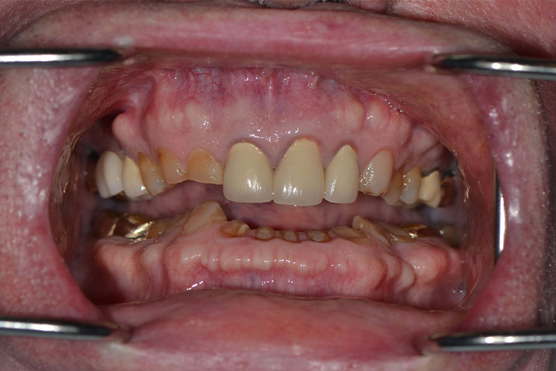 before dental treatment