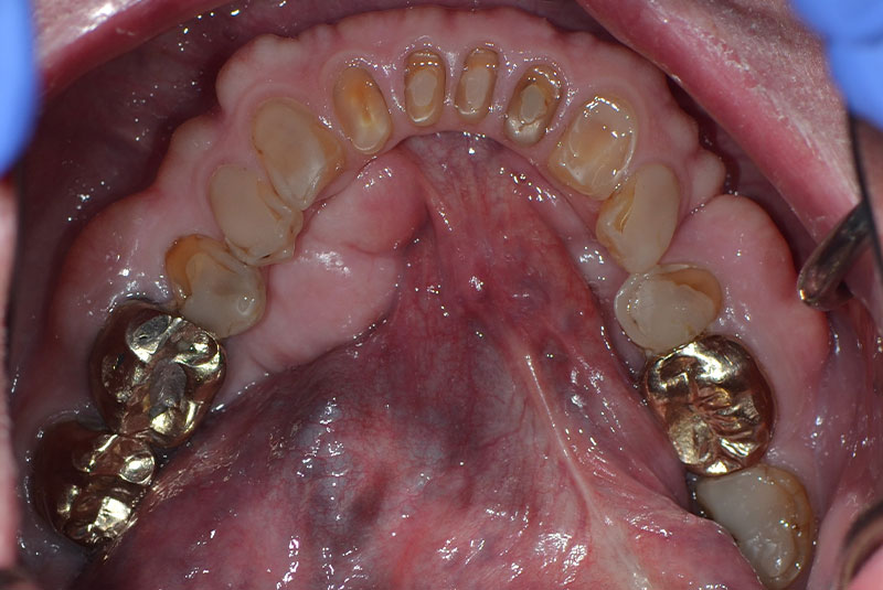 before dental treatment