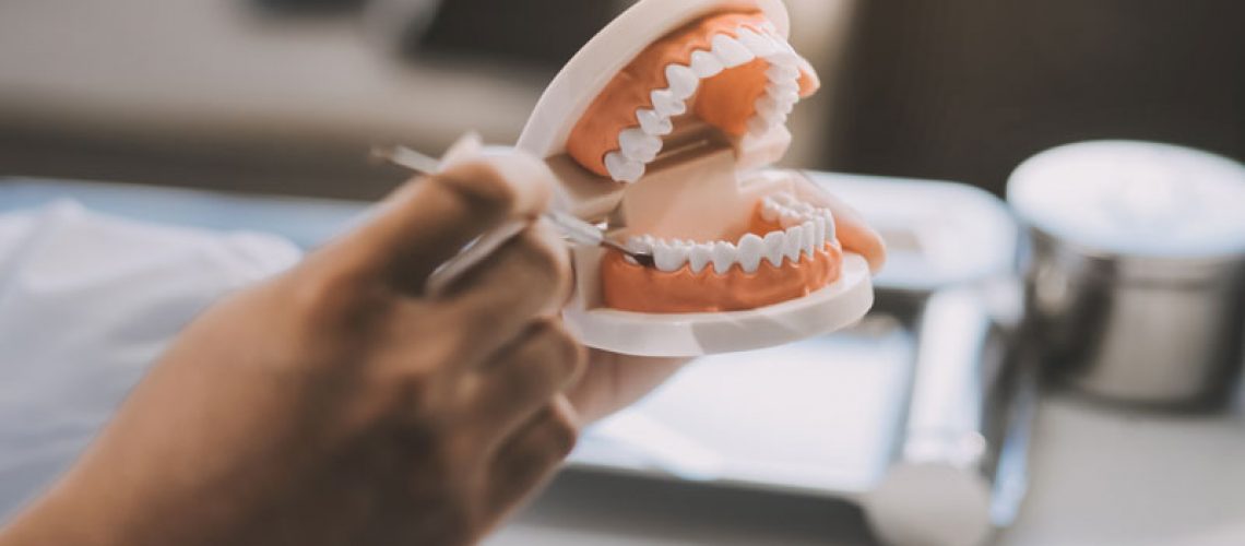 Dentist pointing with pen at dental implant using anatomical model of human jaw during consultation in dental clinic explaining to patient treatment procedure.