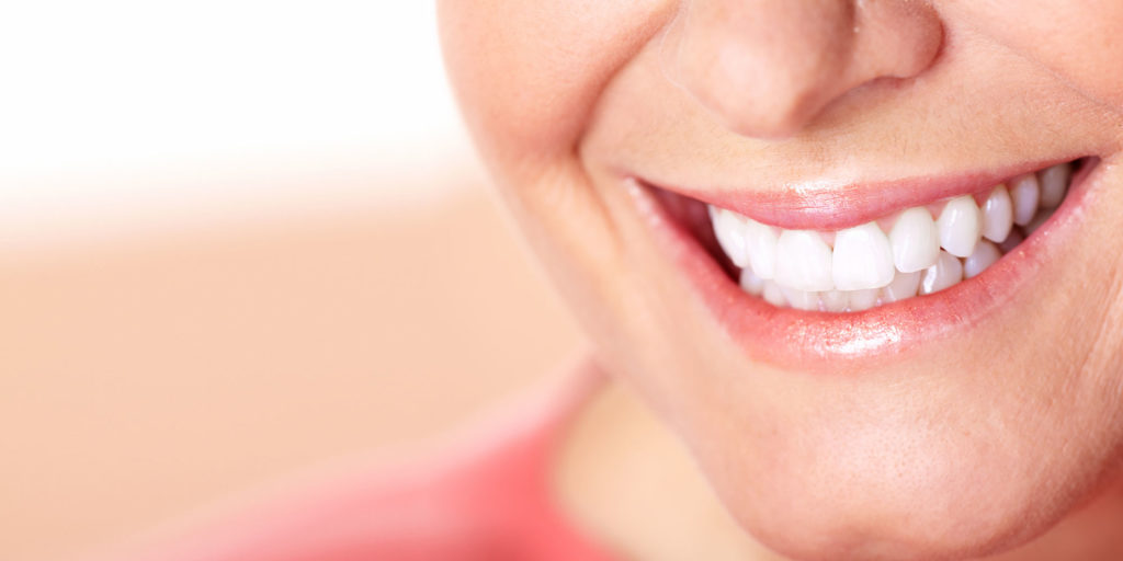 Close-up of a woman smiling with bright white teeth after receiving dentures or cosmetic dental treatment