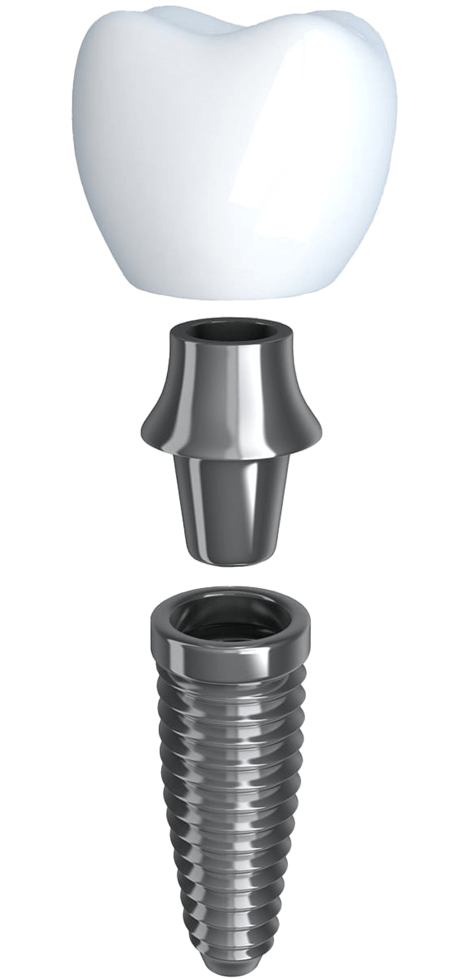 single dental implant